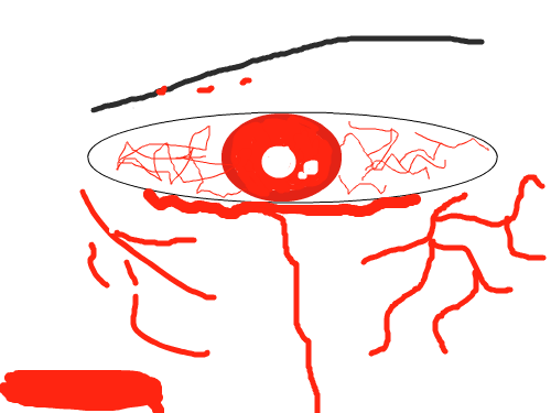 죽음 그리고 피 : 죽음을 앞둔 사람. 스케치판 ,sketchpan