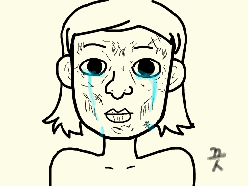 수술실패 : 제목 그대로 수술에 실패한 슬프고도 슬픈 이야기 스케치판 ,sketchpan