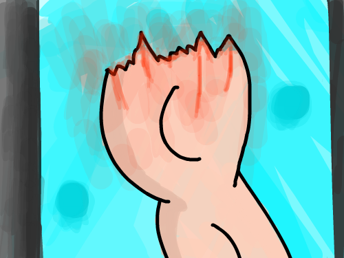 잘린팔 : 위에 피. 스케치판 ,sketchpan