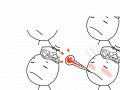 fever : - fever : 열 - feverish : 열이 있는 스케치판 ,sketchpan